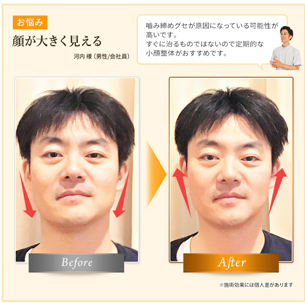 Before,After_河内様